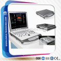 портативный ультразвуковой&amp;maquina-де-ultrasone &amp;ultrasound doppler color scanner DW-C60PLUS